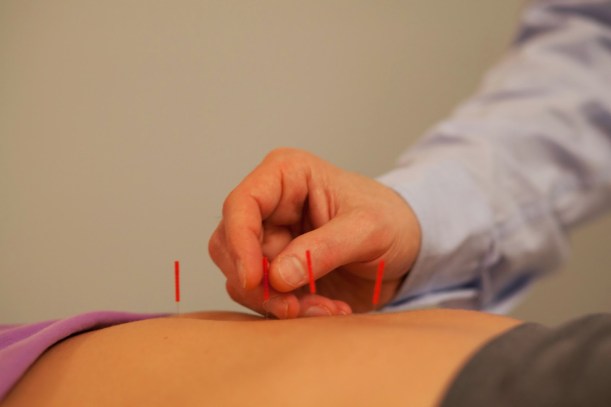 acup_bx_107_img_6359